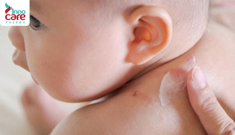 Khi nào có thể dùng kem bôi nano bạc cho trẻ sơ sinh? 1