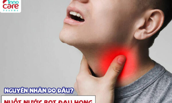 Cách trị nuốt nước bọt đau họng tại nhà hiệu quả nhanh nhất