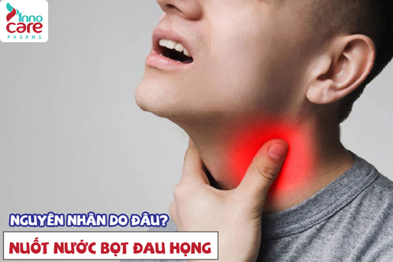 Cách trị nuốt nước bọt đau họng tại nhà hiệu quả nhanh nhất