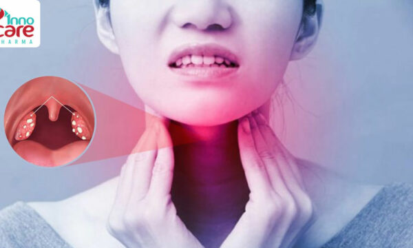 Nuốt nước bọt đau họng có phải bị covid không?