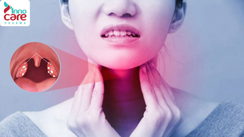 Nuốt nước bọt đau họng có phải bị covid không?