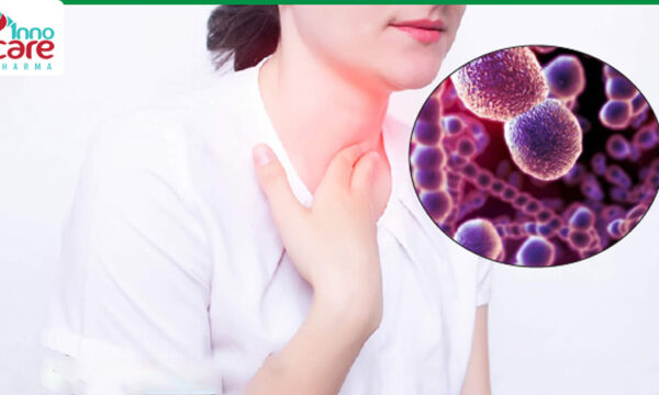 Viêm họng mãn tính: Nguyên nhân, triệu chứng và cách điều trị