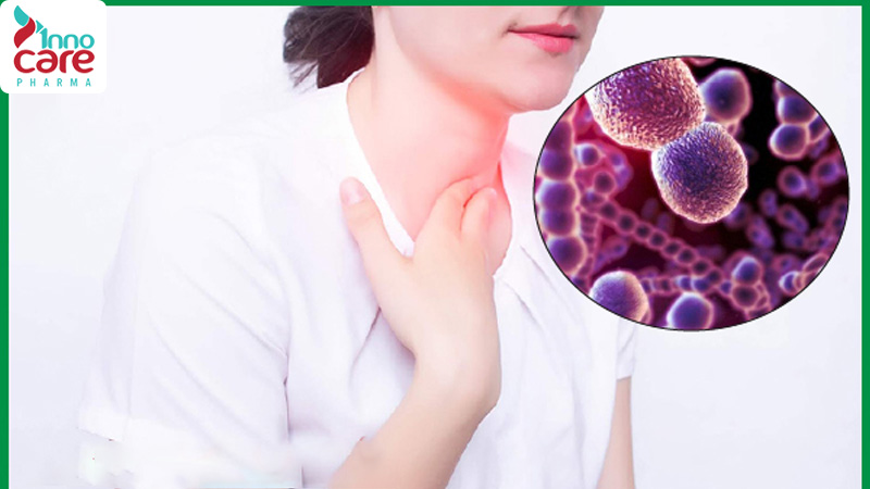 Viêm họng mãn tính: Nguyên nhân, triệu chứng và cách điều trị