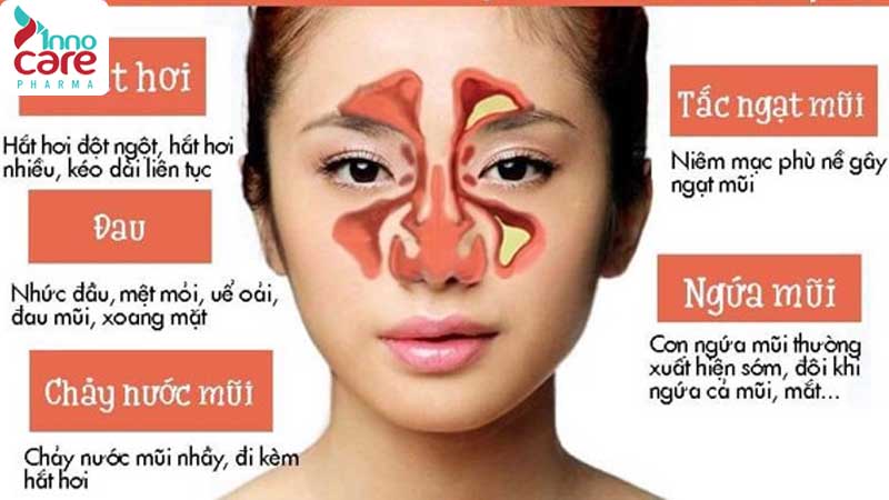Triệu chứng phổ biến 1 Viêm mũi dị ứng: Nguyên nhân, dấu hiệu nhận biết và cách điều trị