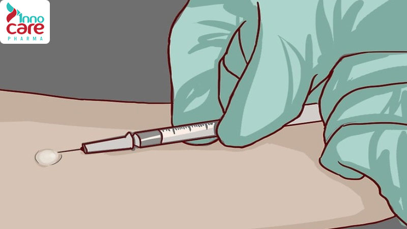 1. Điều trị đặc hiệu (giải mẫn cảm) 1 Viêm mũi dị ứng: Nguyên nhân, dấu hiệu nhận biết và cách điều trị