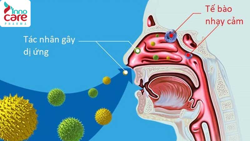 Các chất gây dị ứng trong nhà 1 Viêm mũi dị ứng: Nguyên nhân, dấu hiệu nhận biết và cách điều trị