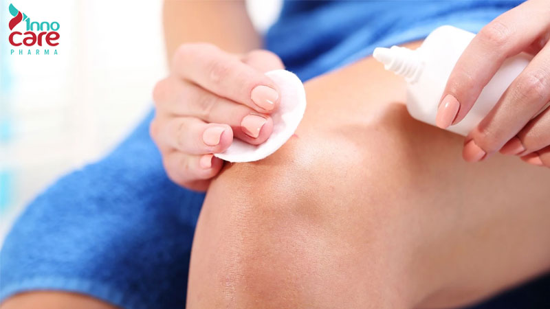 Cách chữa kiến ba khoang đốt an toàn và hiệu quả nhanh