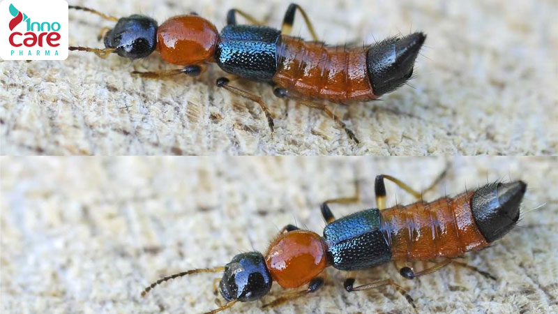 Kiến cánh có độc không? Cách xử lý khi bị kiến cánh cắn