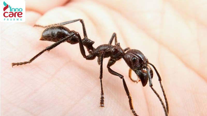 Dấu hiệu nhận biết vết kiến đen cắn 1 Bị kiến đen cắn: Cách xử lý đúng và hiệu quả nhanh nhất