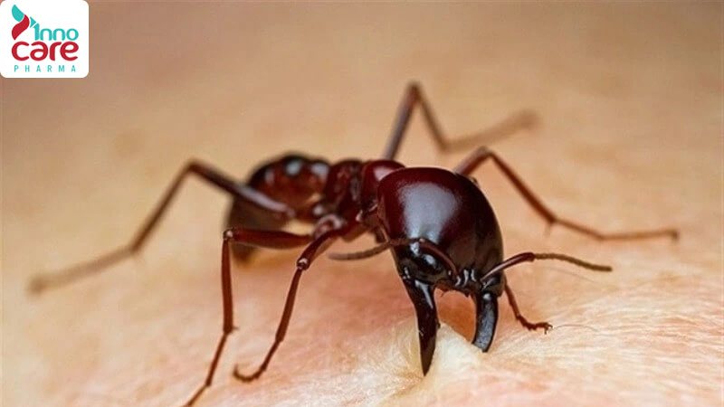 Kiến lửa cắn có sao không? Cách trị kiến lửa cắn hiệu quả nhất