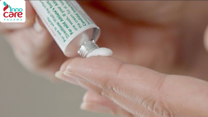 Bị muỗi vằn đốt có sao không? Cách phòng và xử lý hiệu quả