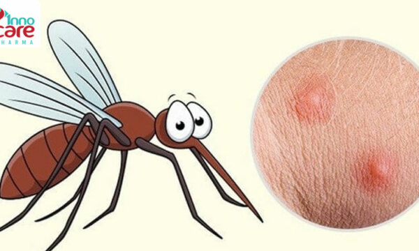 Làm gì để nhanh hết vết muỗi đốt bị sưng đỏ?