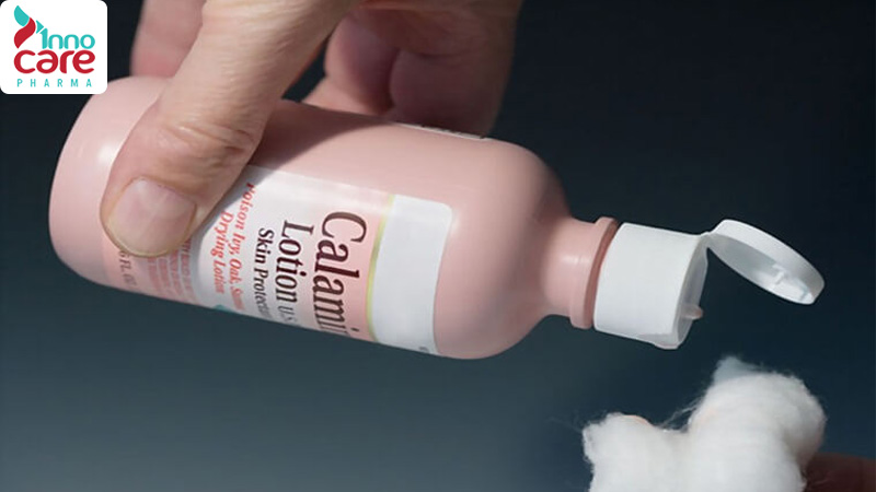 Khi bị muỗi đốt bôi gì cho hết đỏ?